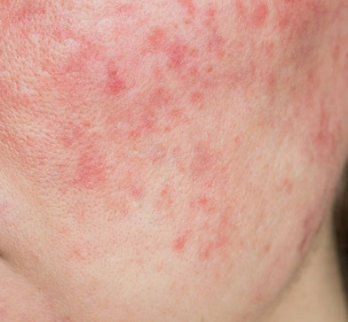 a90c901543121189a6d3618c3682f083_1776155567_1409.png a90c901543121189a6d3618c3682f083_1776155567_1409.png